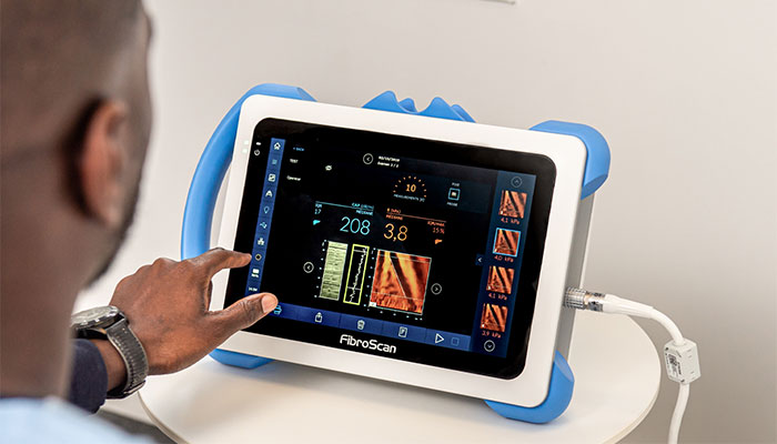Fibroscan